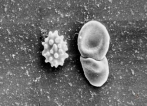 normal blood smear - SEM normal blood smear - SEM